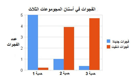 دراسة تربط الغذاء و تسوس الأسنان