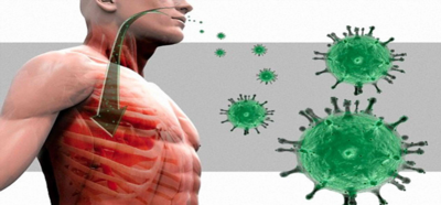 ناقوس الخطر من سارس (SARS) ومن هو على شاكلته