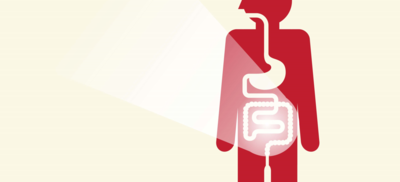 سرطان القولون : مرض ممكن تفاديه