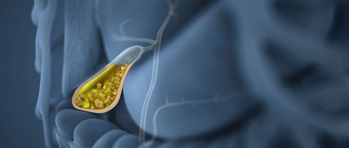 56b98f9688aa5article_1016_1-1 المراره وحصواتها