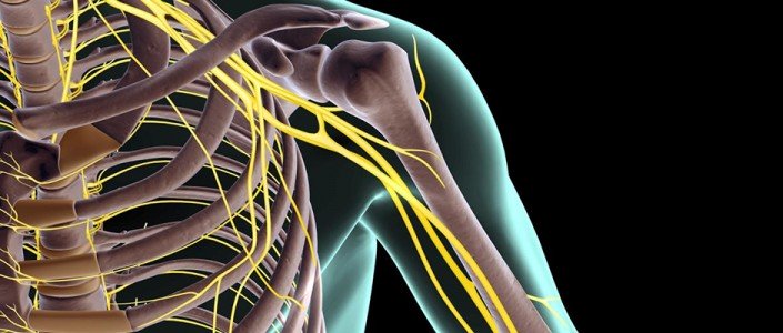 56c5be4932473article_1160_1-1 إصابة الضفيرة العصبية العضدية عند حديثي الولادة