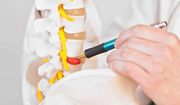 الانزلاق الغضروفي