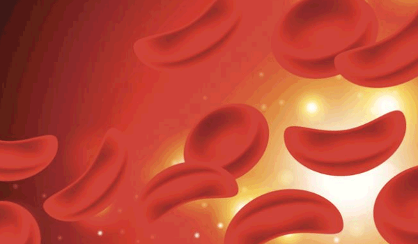 فقر الدم المنجلي