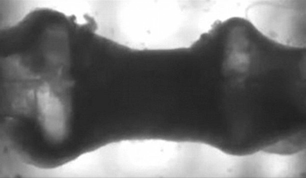 خلايا جذعية