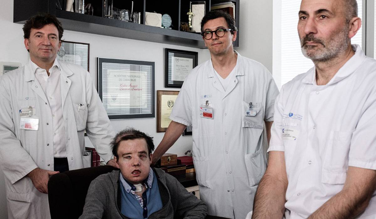 e-28-4 زراعة وجه