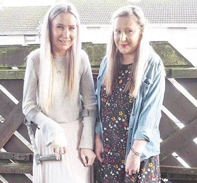 خلل التنسج الليفي