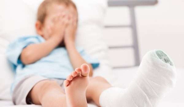 تجبير العظام