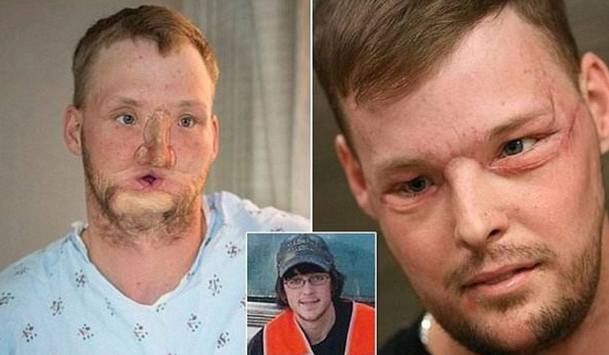 e-9-3 تشوه الوجه