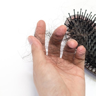 تساقط الشعر