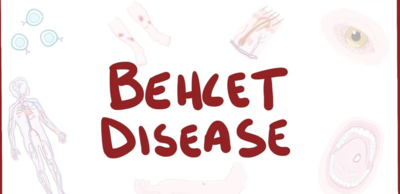 00f599ff49563b0febaddc498b500eb2-1 حقائق هامة عن داء بهجت