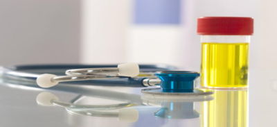 4000c6f09fd605f957b86b20fc5de784-1 أسباب الإصابة بزلال البول وطرق علاجه