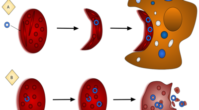 87dfc9a50d09465ac0a34cdf7bfbb7a3-1 الملاريا وفقر الدم المنجلي