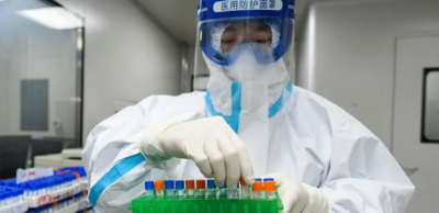 8a8bd02f6f114691fb4a5b1ee34e0585-1 علاج فيروس كورونا المستجد بالخلايا الجذعية