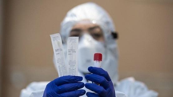 نتائج سلبية للعينات العشوائية بعجلون