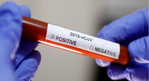 05f901cdf321dbabcbd4f9d93c3d70f0-1 مدى دقة فحص فيروس كورونا (كوفيد-19)