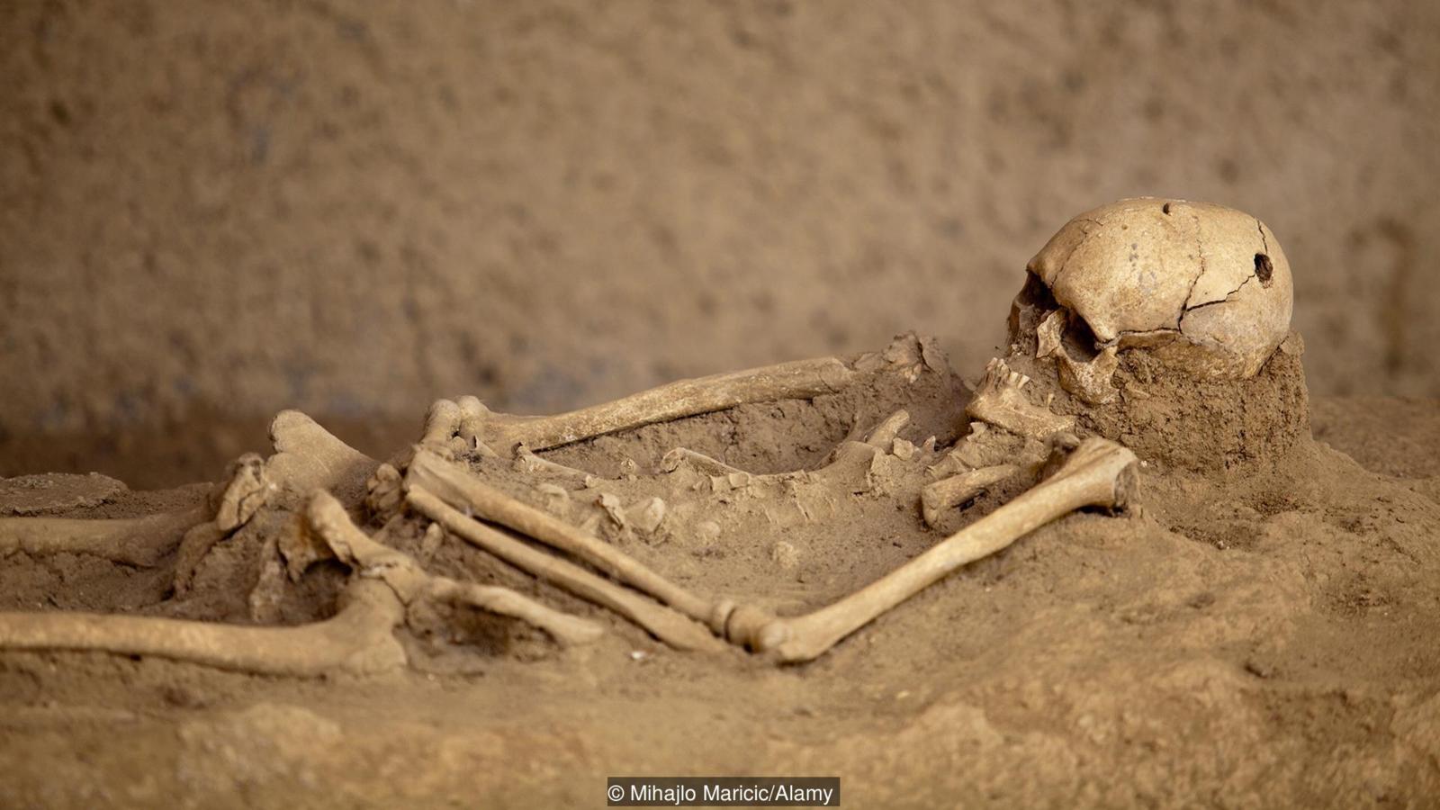 1-d8a7d984d8a5d986d8b3d8a7d986-d8a7d984d982d8afd98ad985-d98ad8abd982d8a8-d8acd985d8acd985d8aad987 الإنسان القديم يثقب جمجمته