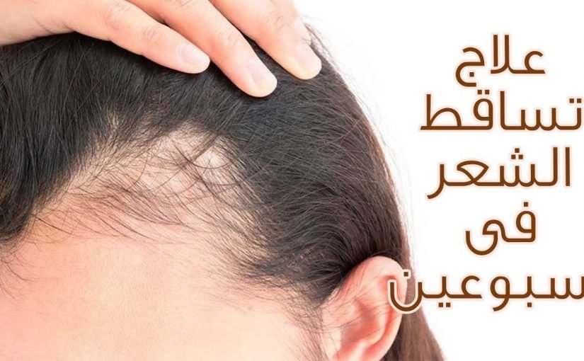 10 خلطات لعلاج تساقط الشعر