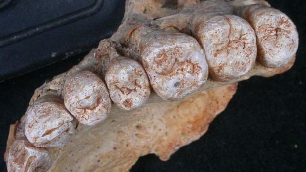 104958891_10 فك بشري