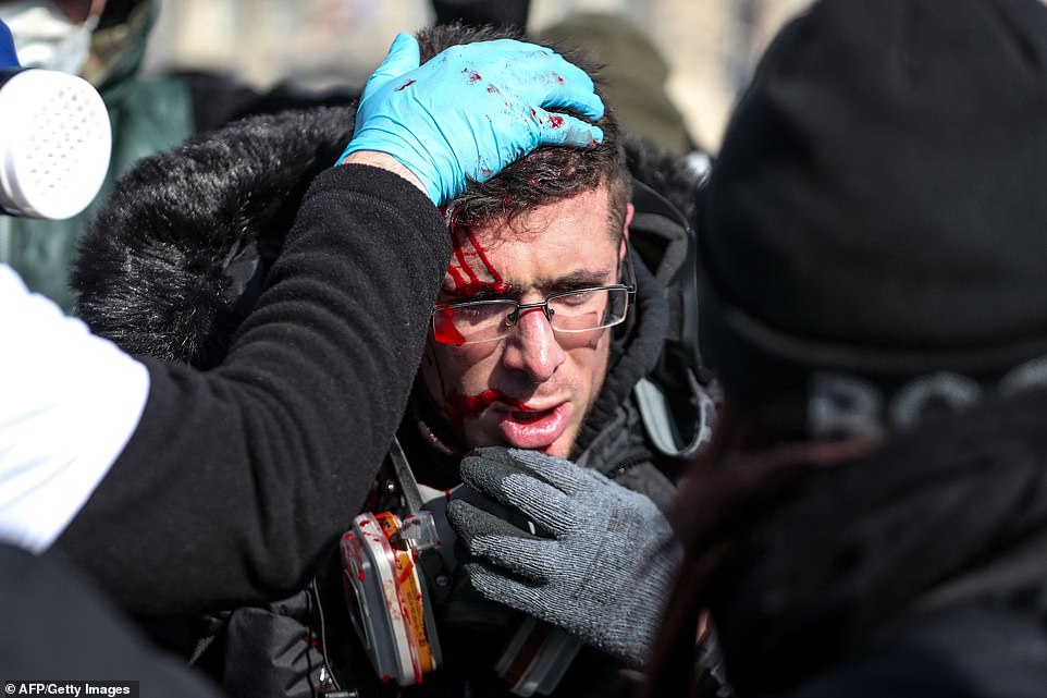 11077160-6816815-image-a-33_1552749994973 An injured protester pictured during clashes with riot forces on the Champs-Elysees today. Around 12 members of the Yellow Vest movement have died at blockades organised at major roads around France, while hundreds of others have been injured in rioting