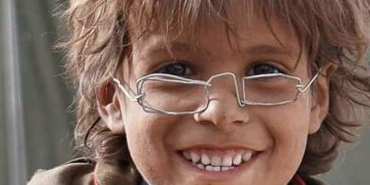 200676-750x375-2 نظارة حديدية لطفل تلهم الآلاف.. إنها كسوة العيد