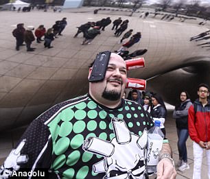 3eb556dc00000578-0-image-a-45_1490727672492 Not only is he able to stick objects to his skin, but his wounds heal faster, he gets sick less and ages slower than the average person'Maybe 'Can Head Suction Disease,' he said, before changing his mind