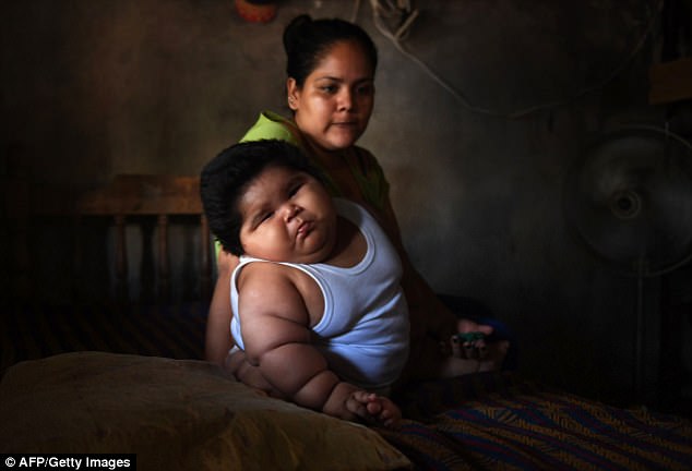 Now she and husband Mario have to push Luis for daily blood tests at a nearby hospital where doctors believe he may be suffering from Prader-Willi Syndrome
