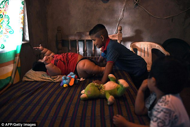 While most Prader-Willi sufferers constantly bed for food, Luis does not, leading to an alternative theory that he is suffering from a hormone imbalance