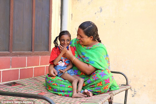 The desperate parents are now looking for a miracle that would treat their first child's condition and prolong her life. Her mother added: 'She is different but she is our most favourite. When she was born people had said she would not survive for more than a few days but she just turned 18'