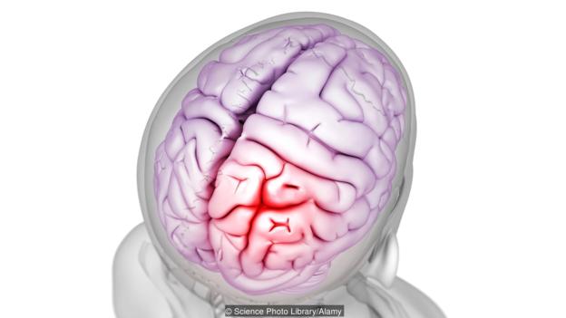 5-d8a7d984d8a5d986d8b3d8a7d986-d8a7d984d982d8afd98ad985-d98ad8abd982d8a8-d8acd985d8acd985d8aad987 الإنسان القديم يثقب جمجمته