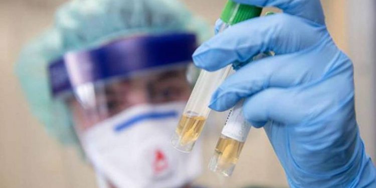 85555555555-750x375-2 دراسة تحذر من إنهاء عمليات الإغلاق قبل تطوير لقاح لكورونا