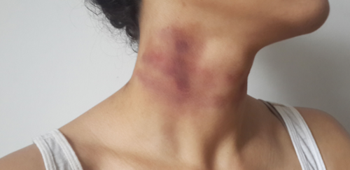 c685becc9739457b2b970c123afcdeff-1 أم إماراتية تدق ناقوس الخطر بعد نجاة ابنها من لعبة الاختناق