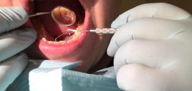 ألم الأسنان للأطفال ألم الأسنان للأطفال