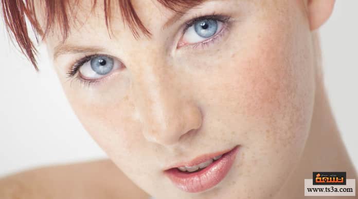 d8a5d8b2d8a7d984d8a9-d8a7d984d986d985d8b4-d8a5d8b2d8a7d984d8a9-d8a7d984d986d985d8b4-d8a8d8b7d8b1d982-d8b7d8a8d98ad8b9d98ad8a9 إزالة النمش إزالة النمش بطرق طبيعية