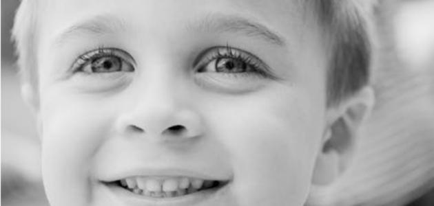 اصفرار اسنان الاطفال اصفرار اسنان الاطفال