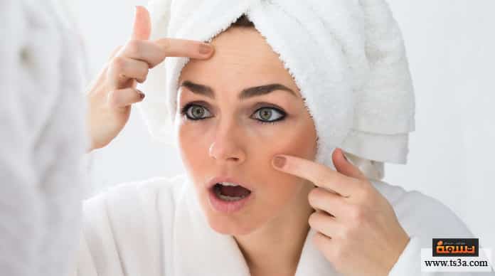 البقع البنية علاج البقع البنية على الوجه بالأعشاب