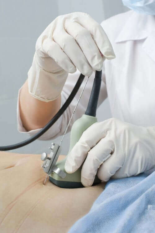 الموجات فوق الصوتية