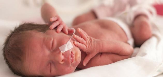 انبوب التغذية عن طريق الأنف انبوب التغذية عن طريق الأنف