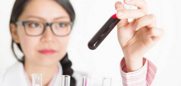 تحليل الدم تحليل الدم