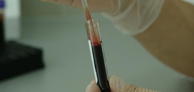 تحليل سرعة الترسيب