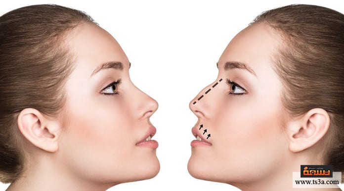 تصغير أرنبة الأنف تصغير أرنبة الأنف بدون جراحة