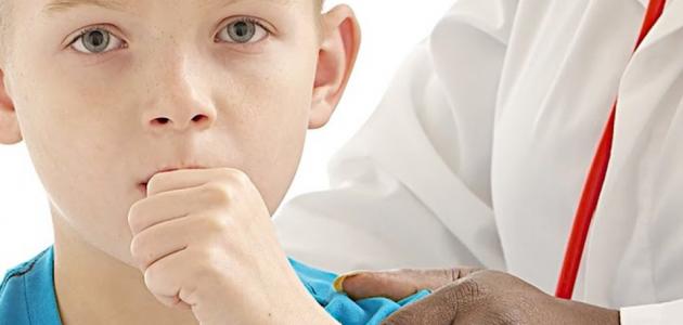 طرق علاج السعال الديكي طرق علاج السعال الديكي