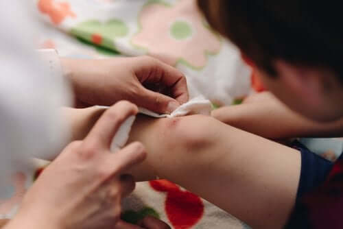 إغلاق الجرح بطريقة صحيحة