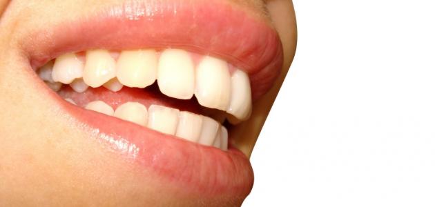 علاج التهاب الفم واللسان علاج التهاب الفم واللسان