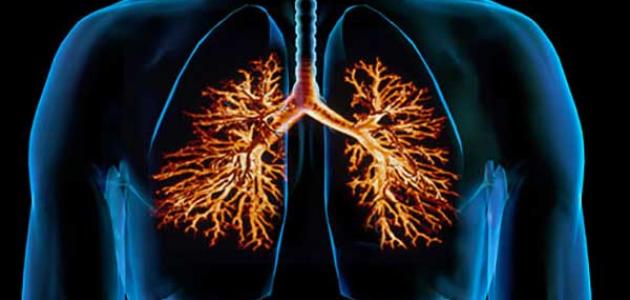 علاج التهاب القصبة الهوائية علاج التهاب القصبة الهوائية