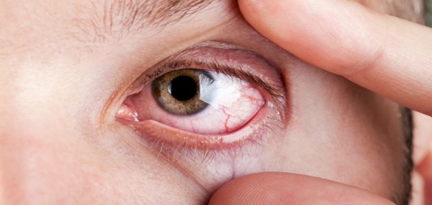 عملية استئصال الزجاجية: أسباب إجرائها والنتائج المنتظرة منها