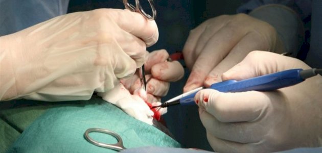 عملية زراعة النخاع العظمي: أسباب إجرائها والنتائج المنتظرة منها عملية زراعة النخاع العظمي: أسباب إجرائها والنتائج المنتظرة منها