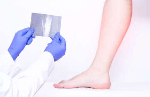 d981d8add8b5-d8aad982d984d8b5d8a7d8aa-d8b9d8b6d984d8a7d8aa-d8a7d984d8b3d8a7d982 فحص تقلصات عضلات الساق