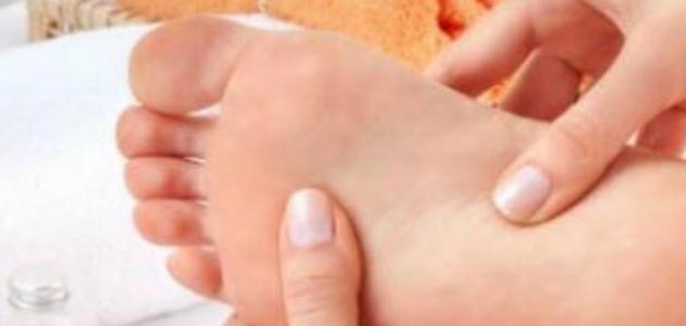 فطريات القدم بين الاصابع فطريات القدم بين الاصابع