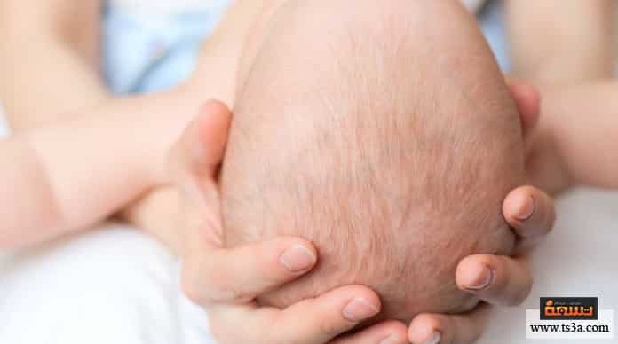 d982d8b4d8b1d8a9-d981d8b1d988d8a9-d8b1d8a3d8b3-d8a7d984d8b1d8b6d98ad8b9-d982d8b4d8b1d8a9-d8b5d981d8b1d8a7d8a1-d981d98a-d8b1d8a3d8b3-d8a7d984d8b1d8b6d98ad8b9 قشرة فروة رأس الرضيع قشرة صفراء في رأس الرضيع