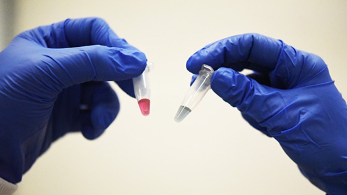 dsc-3709-smaller ÙØªÙجة Ø¨ØØ« Ø§ÙØµÙر ع٠سرطاÙ